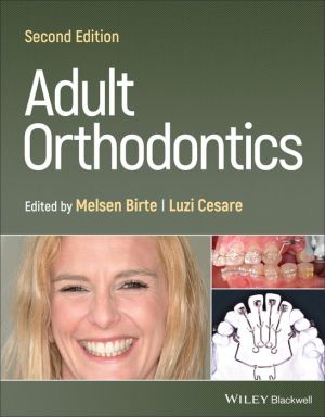 Adult Orthodontics, 2e | ABC Books
