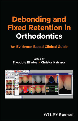 Debonding and Fixed Retention in Orthodontics: An Evidence-Based Clinical Guide | ABC Books