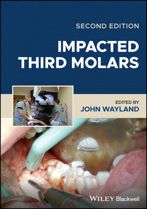 Impacted Third Molars, 2e | ABC Books