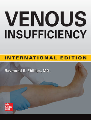 Venous Insufficiency (IE) | ABC Books