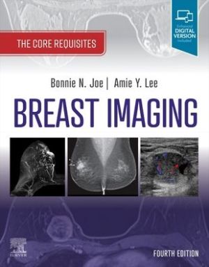 Breast Imaging : The Core Requisites, 4e | ABC Books