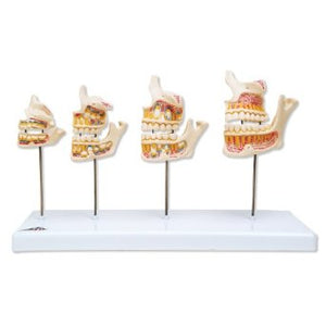 Dentistry Model-Dentition Development Mode-3B(CM):33x20x10 | ABC Books