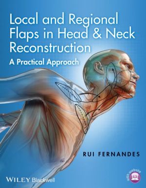 Local and Regional Flaps in Head & Neck Reconstruction: A Practical Approach | ABC Books