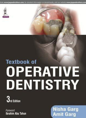 Textbook of Operative Dentistry, 3e** | ABC Books