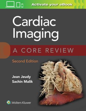 Cardiac Imaging: A Core Review, 2e | ABC Books