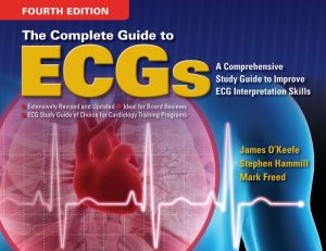 The Complete Guide to ECGs, 4e** | ABC Books
