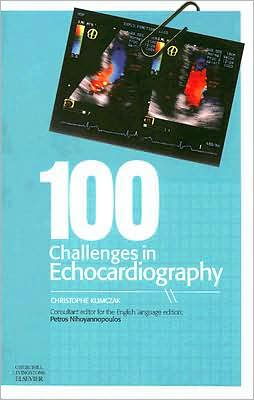 100 Challenges in Echocardiography ** - ABC Books
