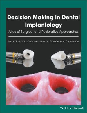 Decision Making in Dental Implantology: Atlas of Surgical and Restorative Approaches | ABC Books