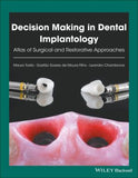 Decision Making in Dental Implantology: Atlas of Surgical and Restorative Approaches | ABC Books