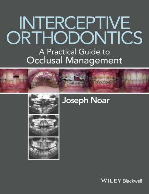 Interceptive Orthodontics: A Practical Guide to Occlusal Management - ABC Books