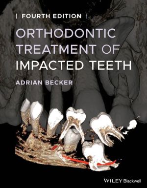 Orthodontic Treatment of Impacted Teeth, 4e | ABC Books