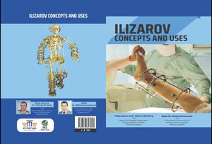 DR. Massoud Notes : Ilizarov - Concepts and Uses | ABC Books