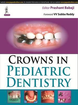 Crowns in Pediatric Dentistry | ABC Books