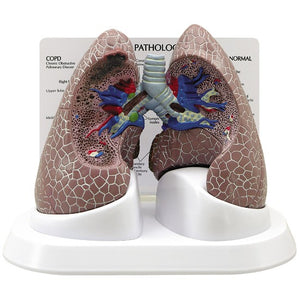 Thoracic Model-Lung Set with Pathologies-2 Parts- GPI (CM): 27x19x17 | ABC Books