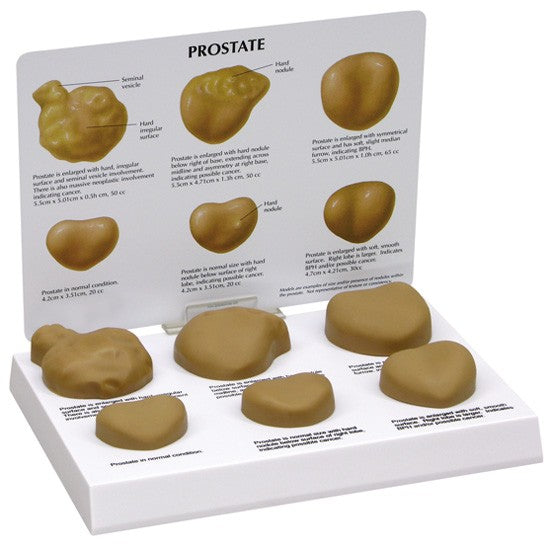 Urology Model- Prostate- Normal + 5 Conditions- GPI (CM):22x15x4