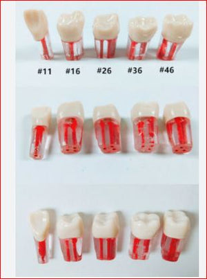 Dental Instruments - Acrylic Teeth with a canal #16 | ABC Books