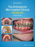 The Orthodontic Mini-implant Clinical Handbook, 2e