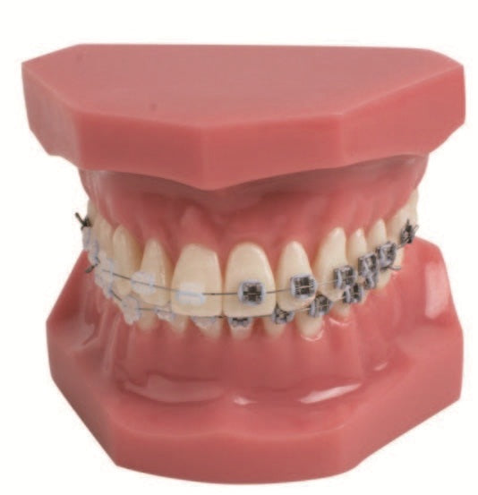 Dentistry Model-Orthodontic Model Half Ceramic Half Metal Bracket Tooth Model-Sciedu(CM):8x7x6