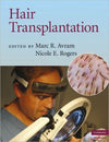 Hair Transplantation | ABC Books