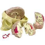 Brain Model-Diseased Brain In Skull-5 Parts-GPI (CM) 19x15x13 | ABC Books