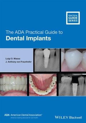 The ADA Practical Guide to Dental Implants | ABC Books