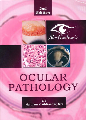 Al-Nashar's Ocular Pathology, 2e | ABC Books