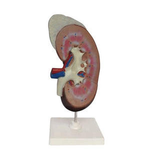 Urology Model- Human Kidney with Adrenal Gland-(CM)15x15x32 | ABC Books