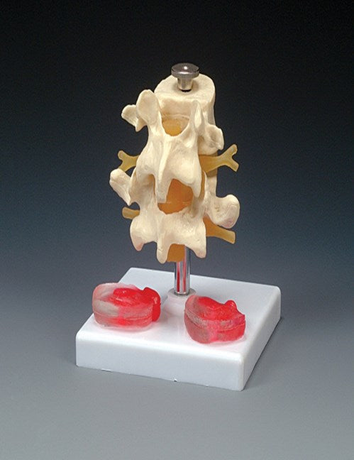 Bone Model-Vertebrae-Budget Lumbar Vertebraewith Interchangeable Discsr-Anatomical-Size(CM): 13x12x12 | Bone Model Vertebrae