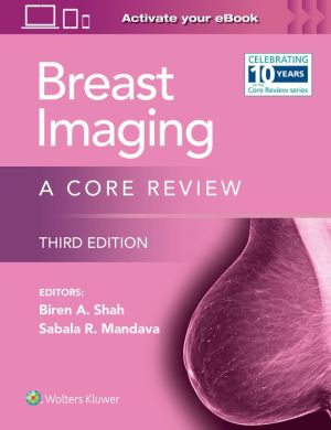Breast Imaging : A Core Review, 3e | ABC Books