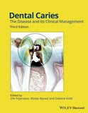 Dental Caries: The Disease and its Clinical Management, 3e | ABC Books