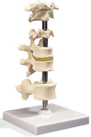 Bone Model-3 Human Lumbar Vertebrae, Flexibly Mounted-3B-Size(CM): 11x10x9 | ABC Books