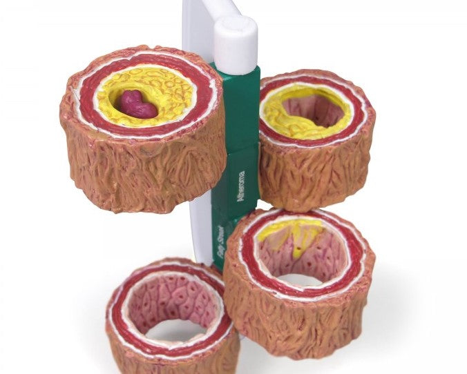 Thoracic Model-4-Piece Artery-GPI-Size(CM): 11x9x6