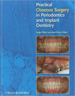 Practical Osseous Surgery in Periodontics and Implant Dentistry | ABC Books