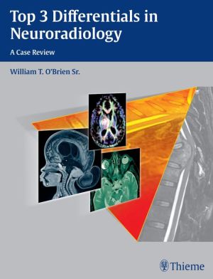 Top 3 Differentials in Neuroradiology | ABC Books