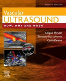 Vascular Ultrasound : How, Why and When, 4e | ABC Books
