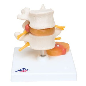 Bone Model-Mini Human Spinal Column Model, Flexible Mounted, on Removable Base- 3B-Size(CM): 13x12x12 | ABC Books