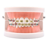 Dentistry Model-Metal Bracket Orthodonics-Sciedu(CM):10x8x5 | ABC Books