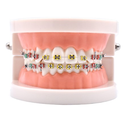 Dentistry Model-Metal Bracket Orthodonics-Sciedu(CM):10x8x5
