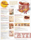 Understanding Skin Cancer Anatomical Chart, 2e | ABC Books