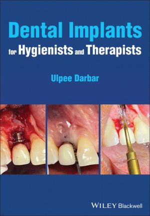 Dental Implants for Hygienists and Therapists | ABC Books