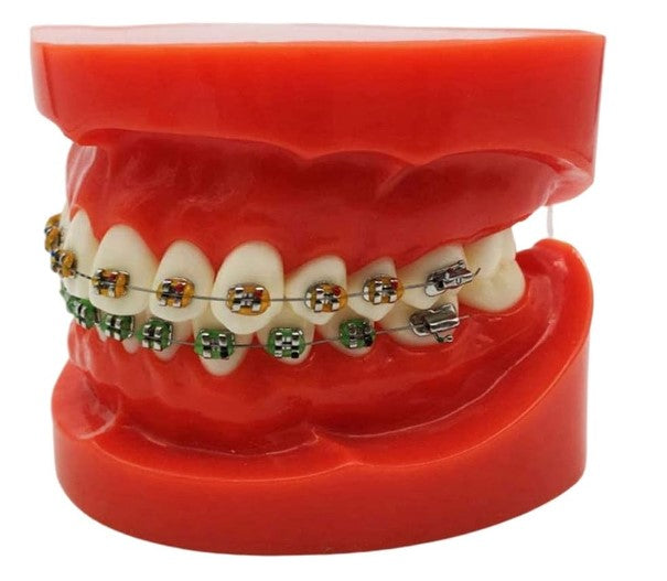 Dentistry Model-Metal Bracket Orthodonics-Sciedu(CM):8x7x6