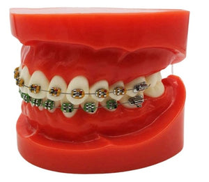Dentistry Model-Metal Bracket Orthodonics-Sciedu(CM):8x7x6 | ABC Books