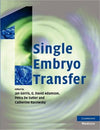 Single Embryo Transfer | ABC Books