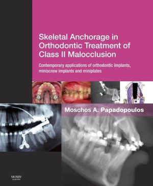 Skeletal Anchorage in Orthodontic Treatment of Class II Malocclusion ** ( USED Like NEW ) | ABC Books