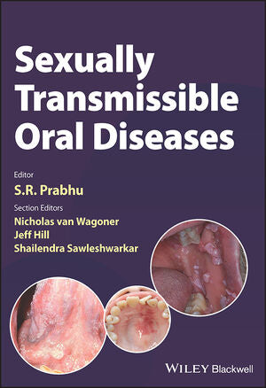Sexually Transmissible Oral Diseases | S. R. Prabhu