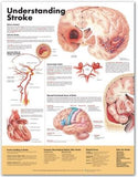 Understanding Stroke Anatomical Chart | ABC Books