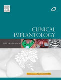 Clinical Implantology | ABC Books