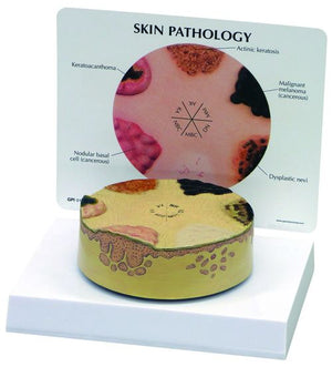 Skin Model-Skin Cancer-3 Cancerous Conditions- GPI (CM): 16x12x16 | ABC Books