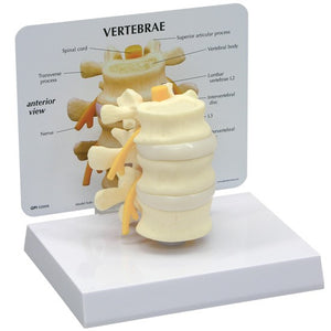 Bone Model-Basic Vertebraem- GPI (CM):17x12x12 | ABC Books