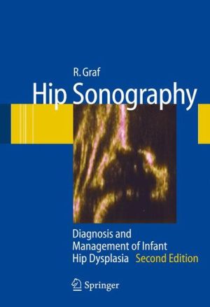 Hip Sonography: Diagnosis and Management of Infant Hip Dysplasia, 2e | ABC Books